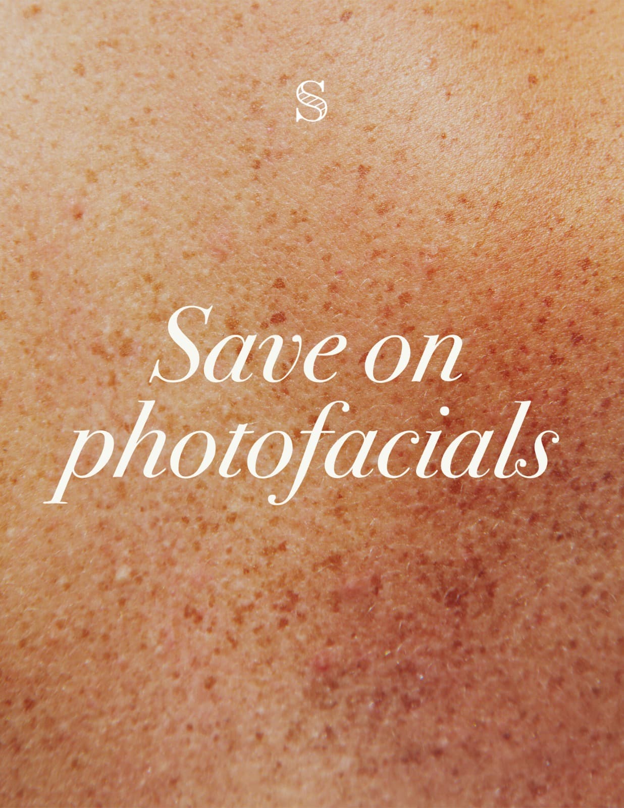 PHOTOFACIAL SPECIAL